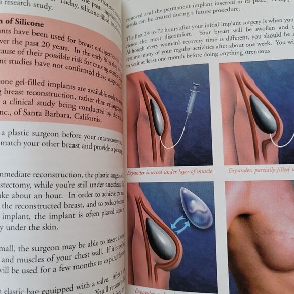 Be A Survivor your guide to breast cancer treatment Vladimir Lange M.D. Oncology - Picture 3 of 5